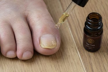Mycose des ongles de pied : quelles huiles essentielles choisir ?